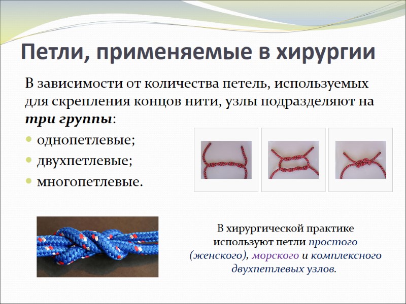 Петли, применяемые в хирургии В зависимости от количества петель, используемых для скрепления концов нити, Петли, применяемые в хирургии В зависимости от количества петель, используемых для скрепления концов нити,
